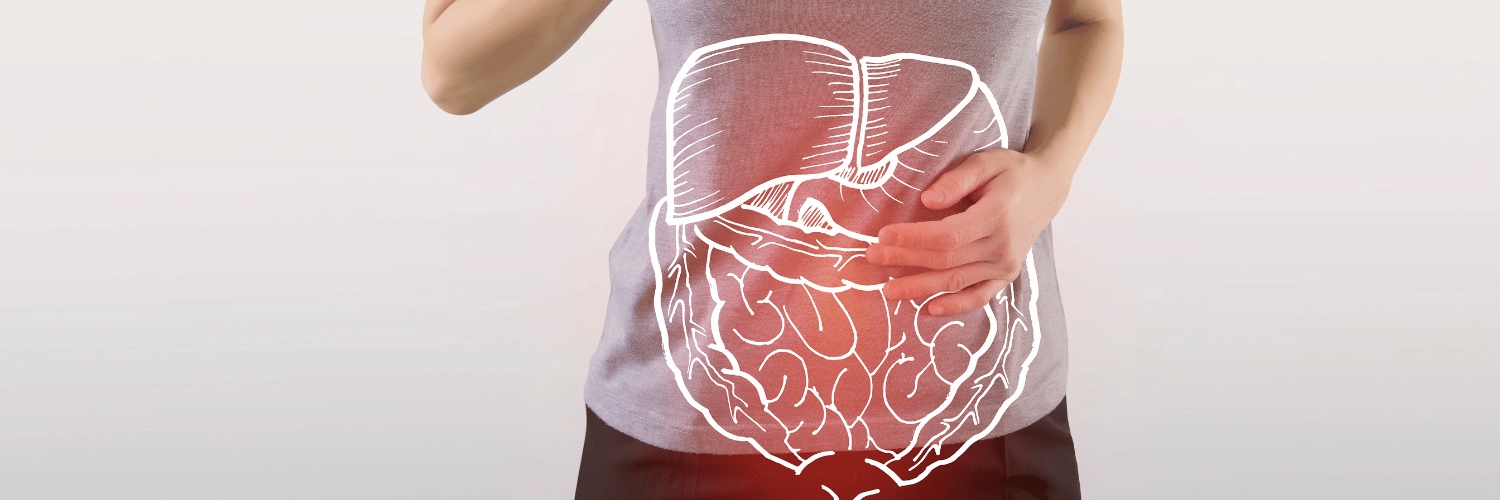 Ulcerative Colitis and Food Intolerances